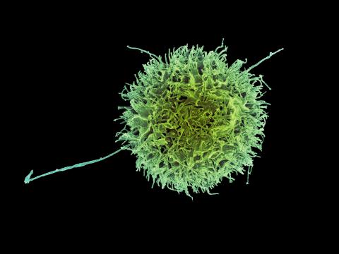 Image of a Natural Killer cell