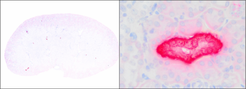 Image of mouse kidney tissue with MPKV detected sparsely