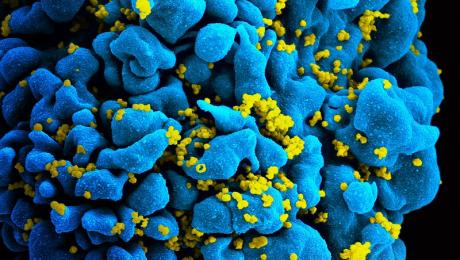 A T cell (blue) infected with HIV (yellow), as seen by scanning electron micrograph. 
