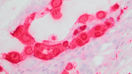 Image of mouse kidney tissue severely affected by MKPV